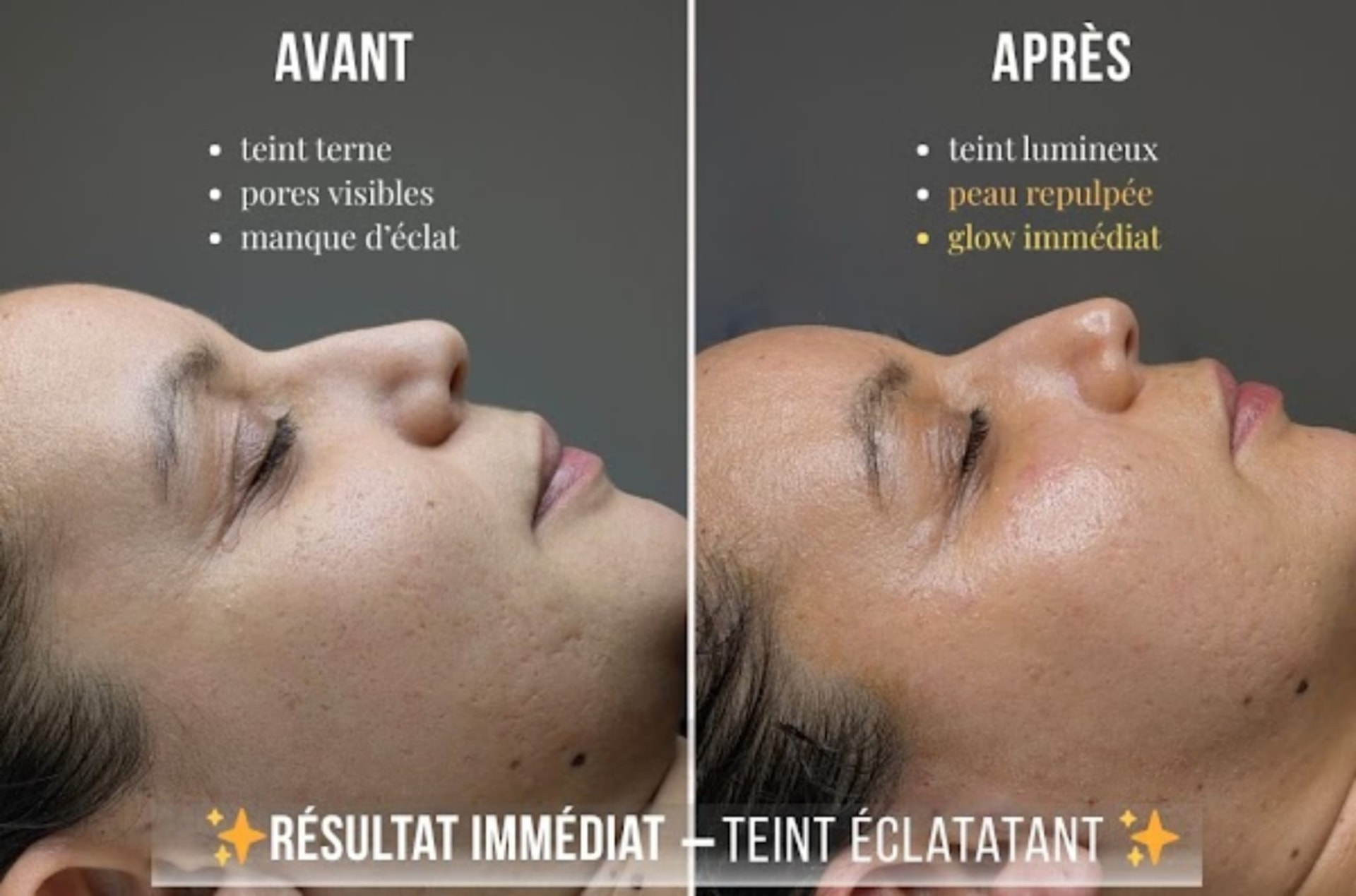Avant / après du soin Éclat chez Âméa